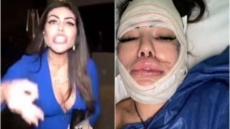 Modelo que atacou policiais em festa clandestina faz cirurgia de emergência