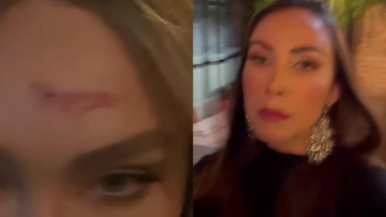 Influenciadora e ex do filho de Bolsonaro brigam em restaurante: "Biscate"