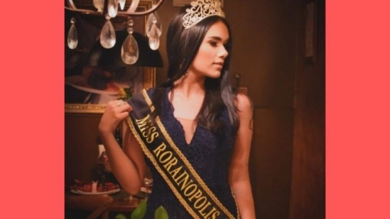 Ex-Miss Roraima Teen morre aos 21 anos após cirurgia para retirar tumor