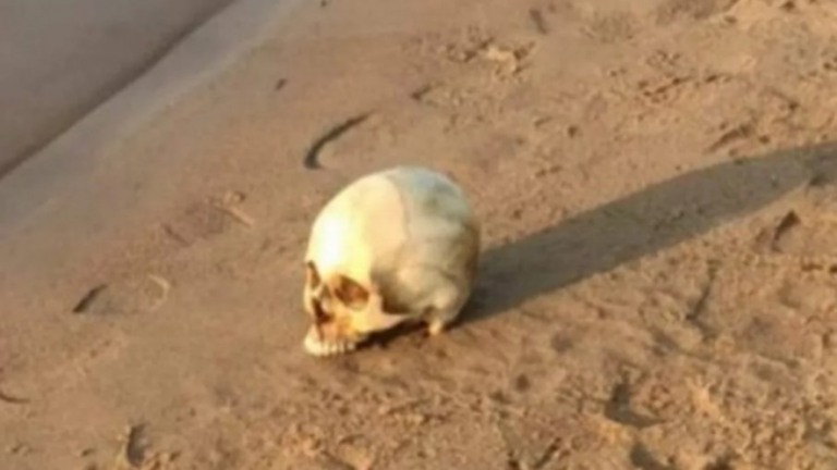 Crânio humano com dentes e aparelho ortodôntico é encontrado no interior do Acre