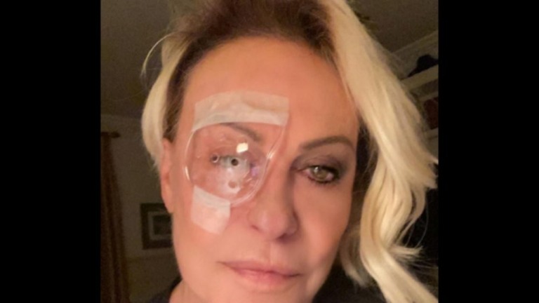 Ana Maria Braga opera da catarata e posta foto de curativo: "Pirata moderna"
