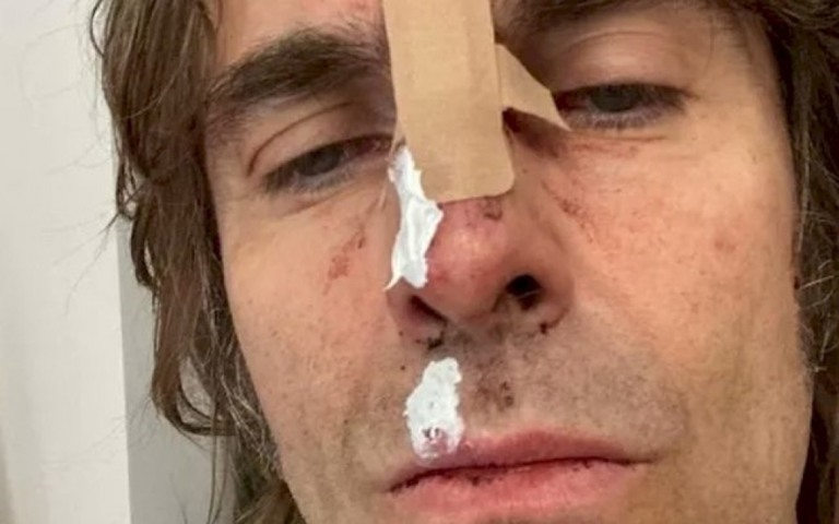 Liam Gallagher cai de helicóptero na Inglaterra