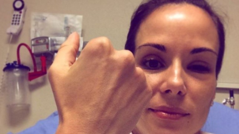 Boninho relembra luta de Ana Furtado contra o câncer de mama: "Medo de perder"