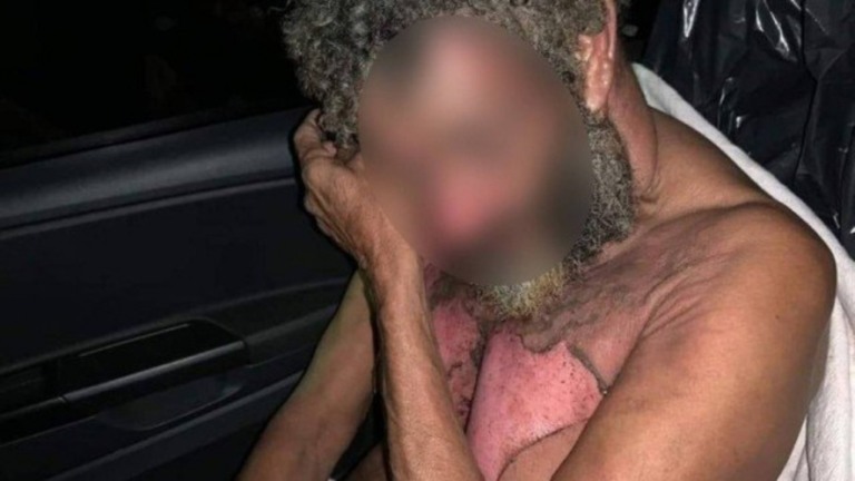 Homem em situação de rua tem corpo queimado enquanto dormia em Nova Iguaçu (RJ)