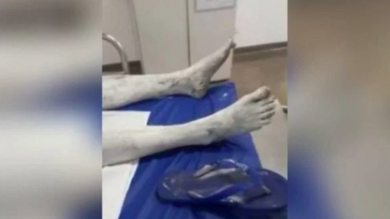 Mulher tem corpo coberto por tinta à óleo e acusa marido de agressão