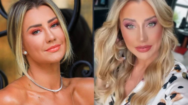 Esposa de Roberto Justus passa por cirurgia plástica e mostra resultado na web