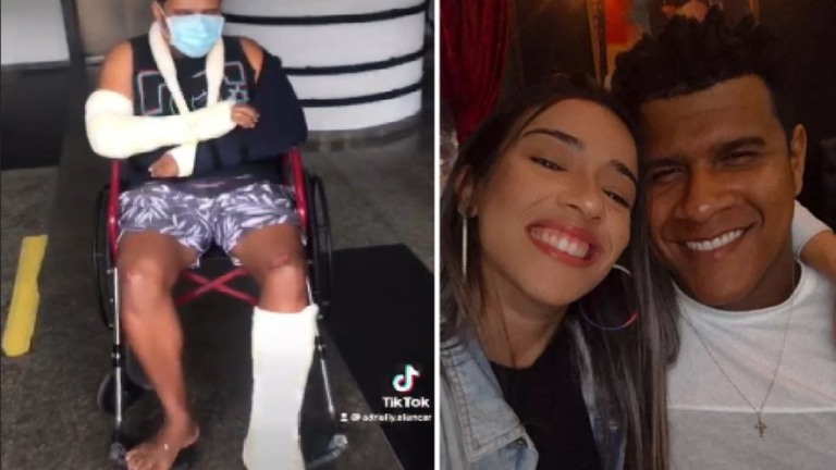 Rapaz fratura ossos ao entregar convites de casamento: "Nunca mais ando de moto"