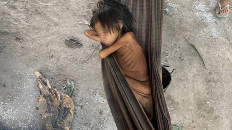 Quarto Yanomami morre vítima de Malária e criança está em estado grave