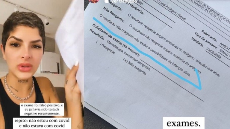 Novos exames de Lary Bottino não descartam infecção por Covid; veja