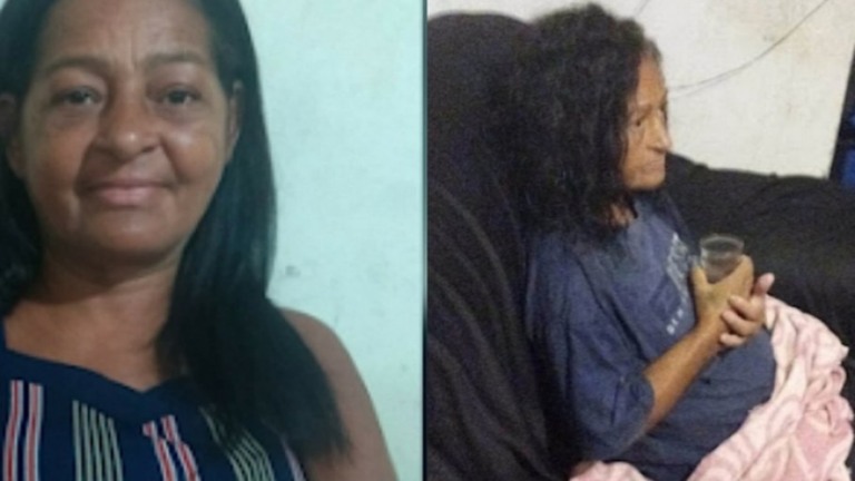 Mulher é enterrada viva na Bahia, escapa, mas fica com sequelas