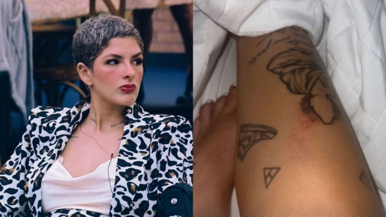 'A Fazenda 13': Lary mostra machucados após empurrão de Liziane