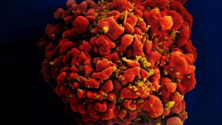 Injeção contra HIV com 90% de eficácia é aprovada por agência dos EUA