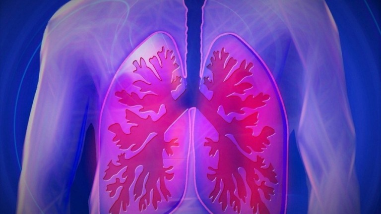 Saiba o que é e quais os sinais de tromboembolismo pulmonar