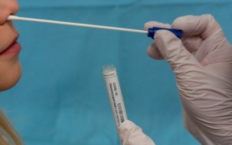 Teste de covid: as respostas às perguntas feitas sobre PCR e antígeno