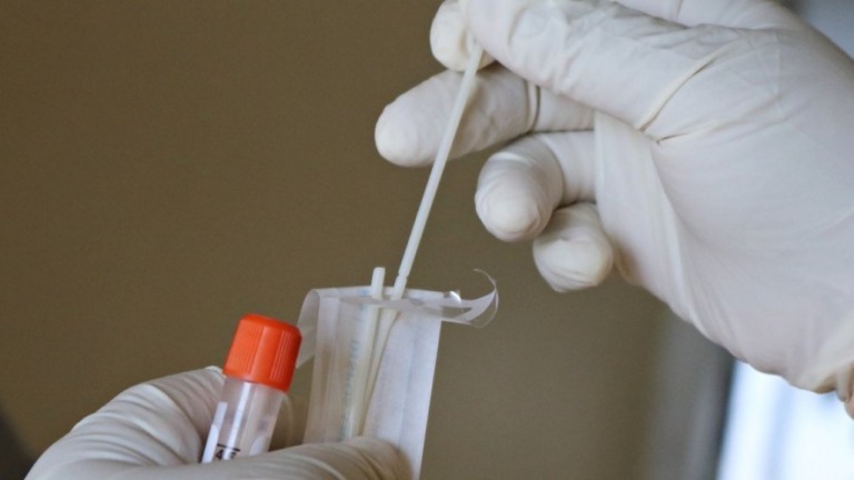 Senacon notifica 14 farmacêuticas por "inflação" dos testes de Covid