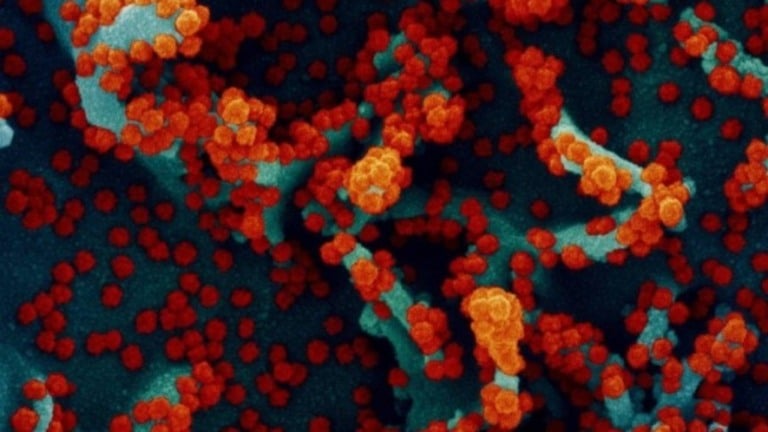 Covid-19: infecção complementa vacina e cria superproteção, diz estudo
