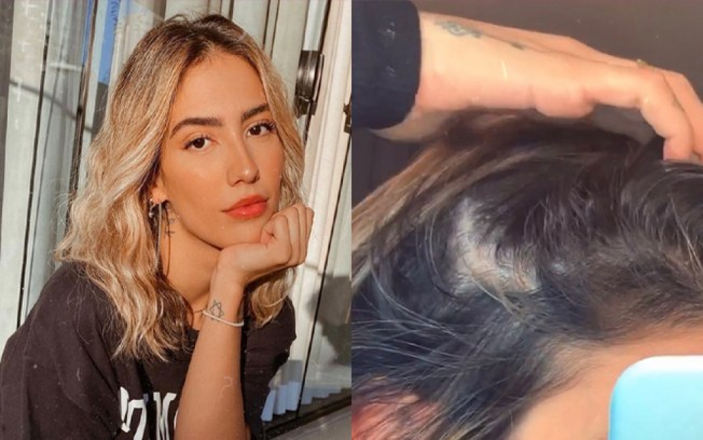 Gabi Brandt fala sobre drama com perda de cabelo