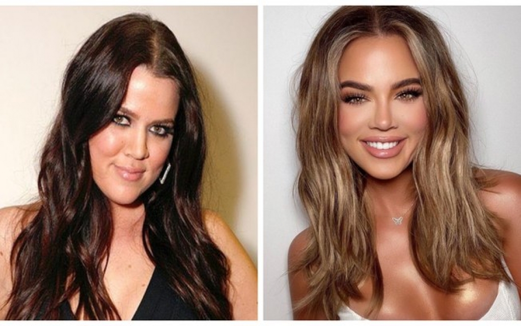 Foto de Khloé Kardashian chama atenção para o antes e depois