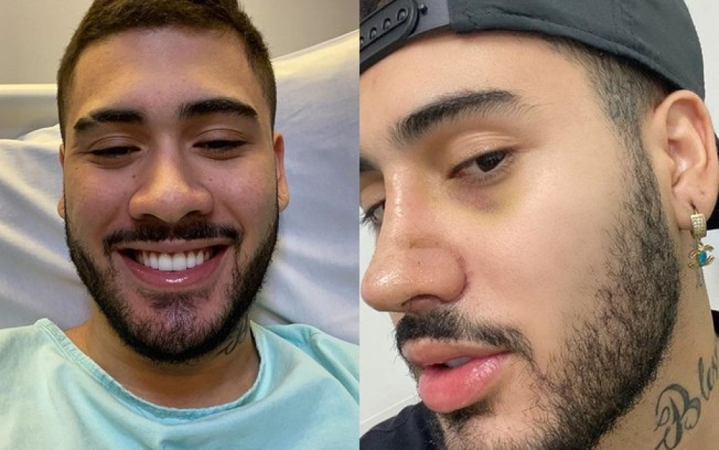 Kevinho mostra antes e depois de cirurgias no nariz