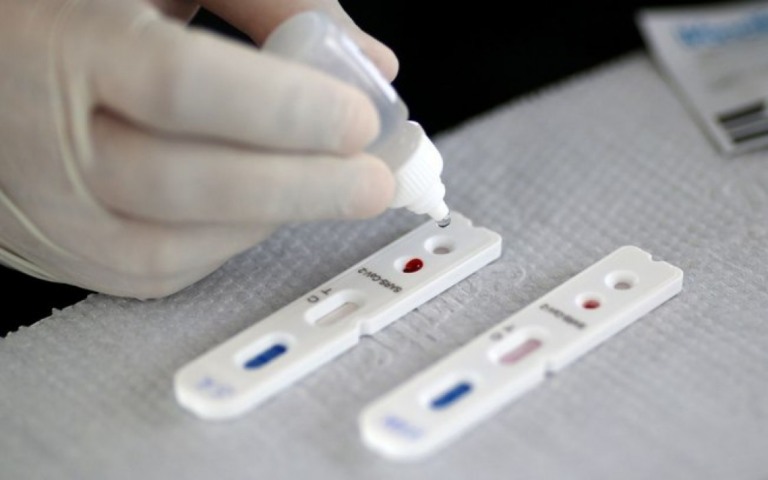 Planos de saúde passam a cobrir testes sorológicos de Covid-19