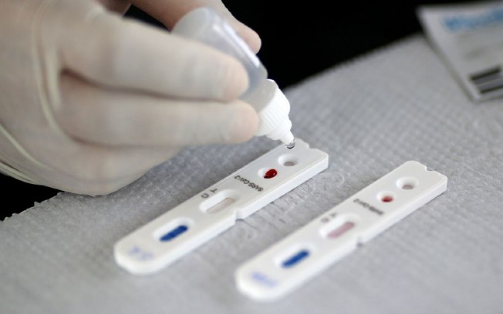 Planos de saúde passam a cobrir testes sorológicos de Covid-19