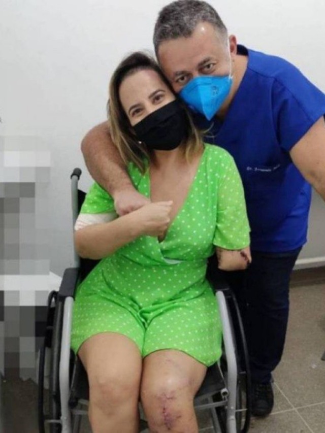 Após sofre grave acidente e amputar um braço, Miss Bumbum agradece médico