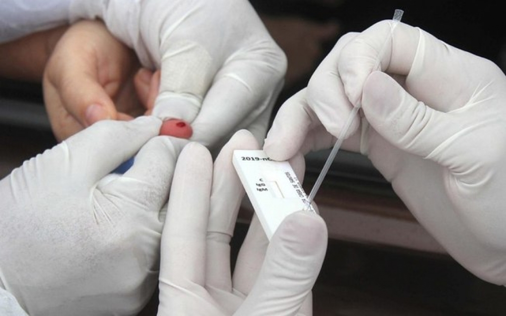 Familiares que moram com infectados pela Covid-19 serão testados em São Paulo Familiares que moram com infectados pela Covid-19 serão testados em São Paulo