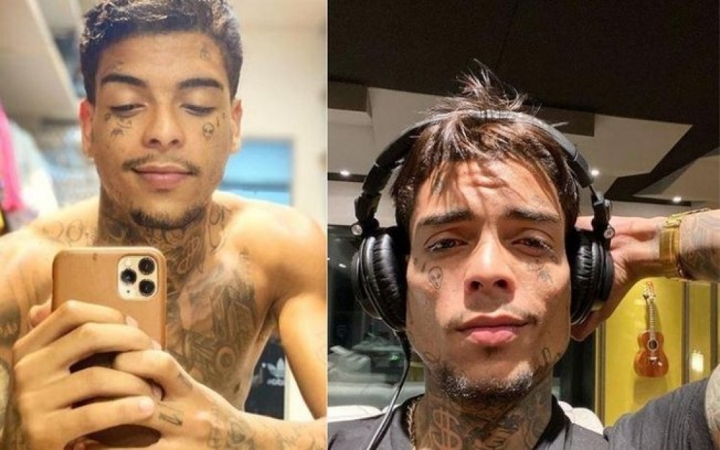 Após harmonização facial, MC Kevin choca os fãs com os resultados