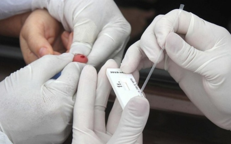 Vereadores do Rio aprovam testagem de Covid-19 em escolas
