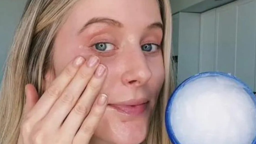 Slugging: tendência do Tik Tok pode causar acne