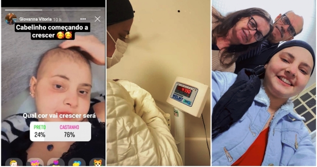 Cresça cabelo – Recuperação de Giovanna após transplante anima família e amigos em Marília