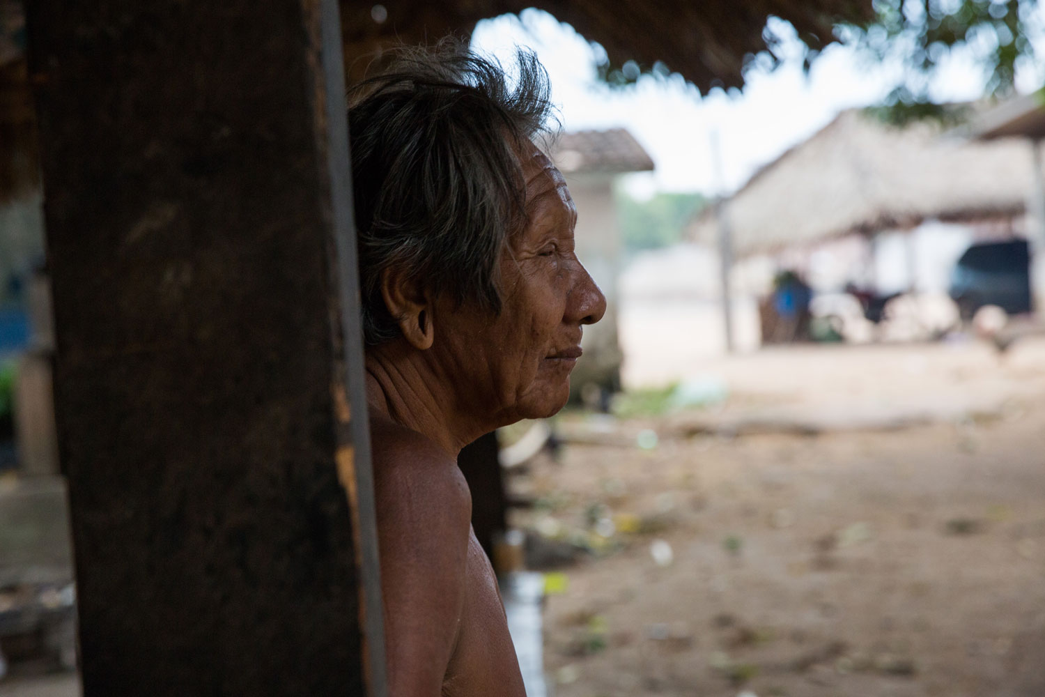 Uma morte a cada quatro dias povo Xikrin é o mais afetado pela Covid-19 no Pará_img2
