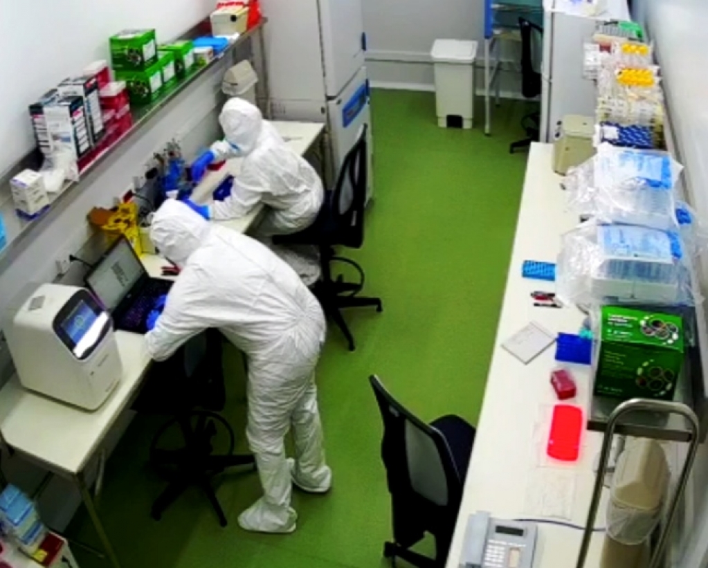 USP mostra perda de memória e atenção em casos leves de Covid-19