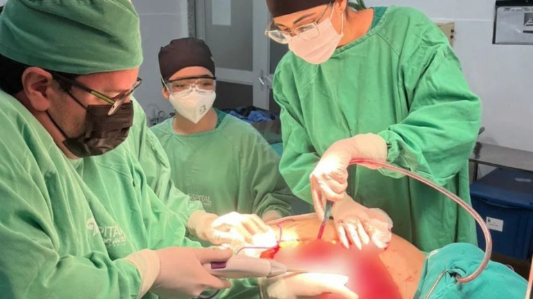 Mulher que removeu tumor de 46 kg morre 11 dias após cirurgia no Rio