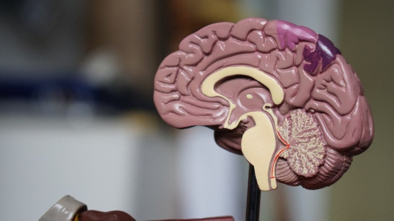 Alzheimer pode apresentar sinais 10 anos antes do diagnóstico