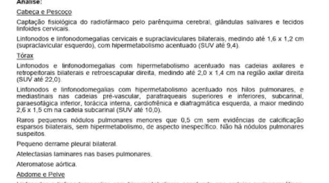 Golpes usam nome do bispo e falso caso de câncer em Marília