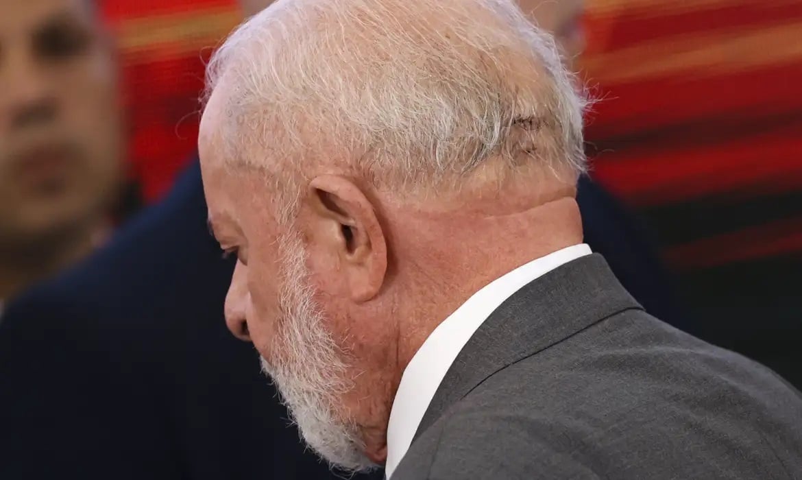 Lula terá novo procedimento nesta quinta para