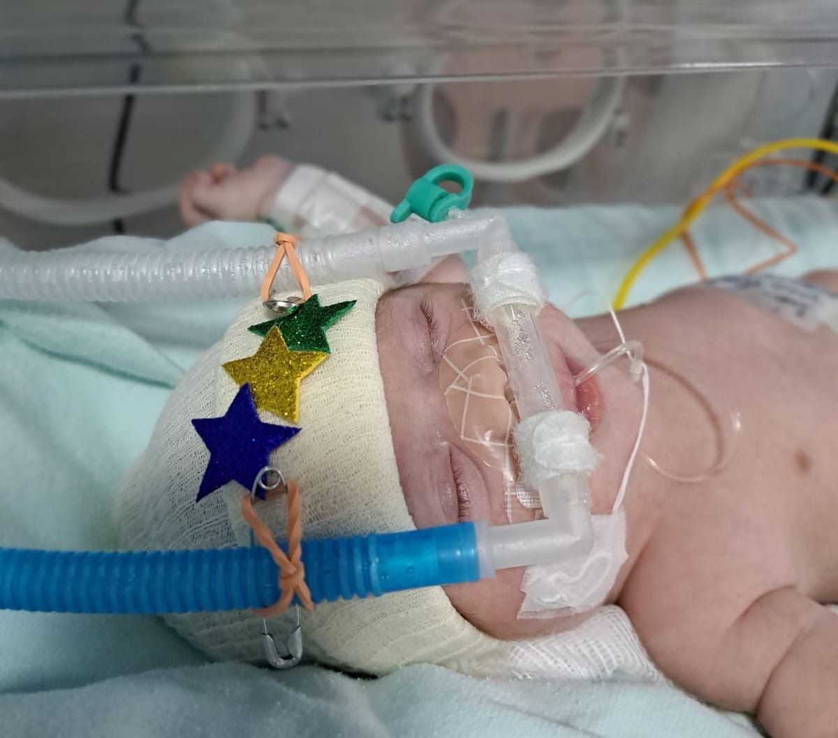 UTI Neonatal em Marília usa clima de copa para acolhimento a famílias